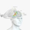 Транскраниальная магнитная стимуляция Транскраниальная магнитная стимуляция